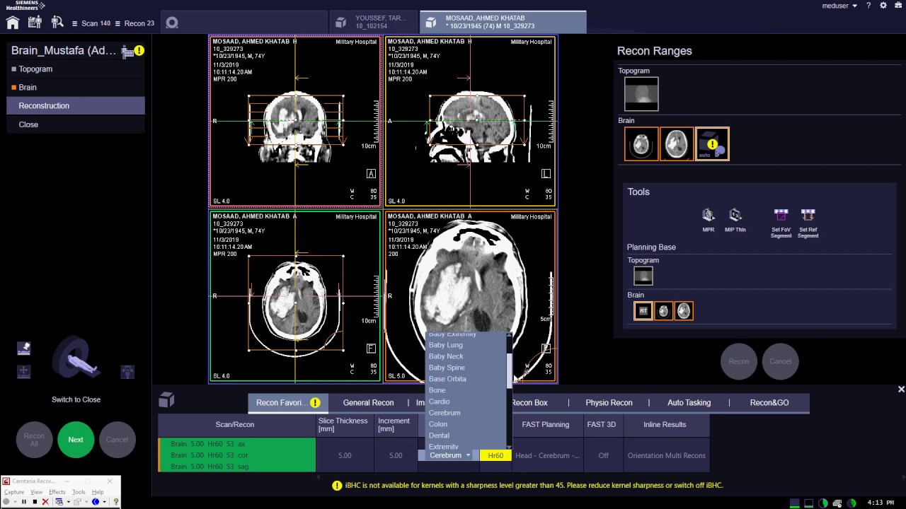 How to use Fix Axial&Inline Result?SIEMENS CT SOMARIS X or 10شرح السوفت وير الأشعه المقطعيه سيمنس