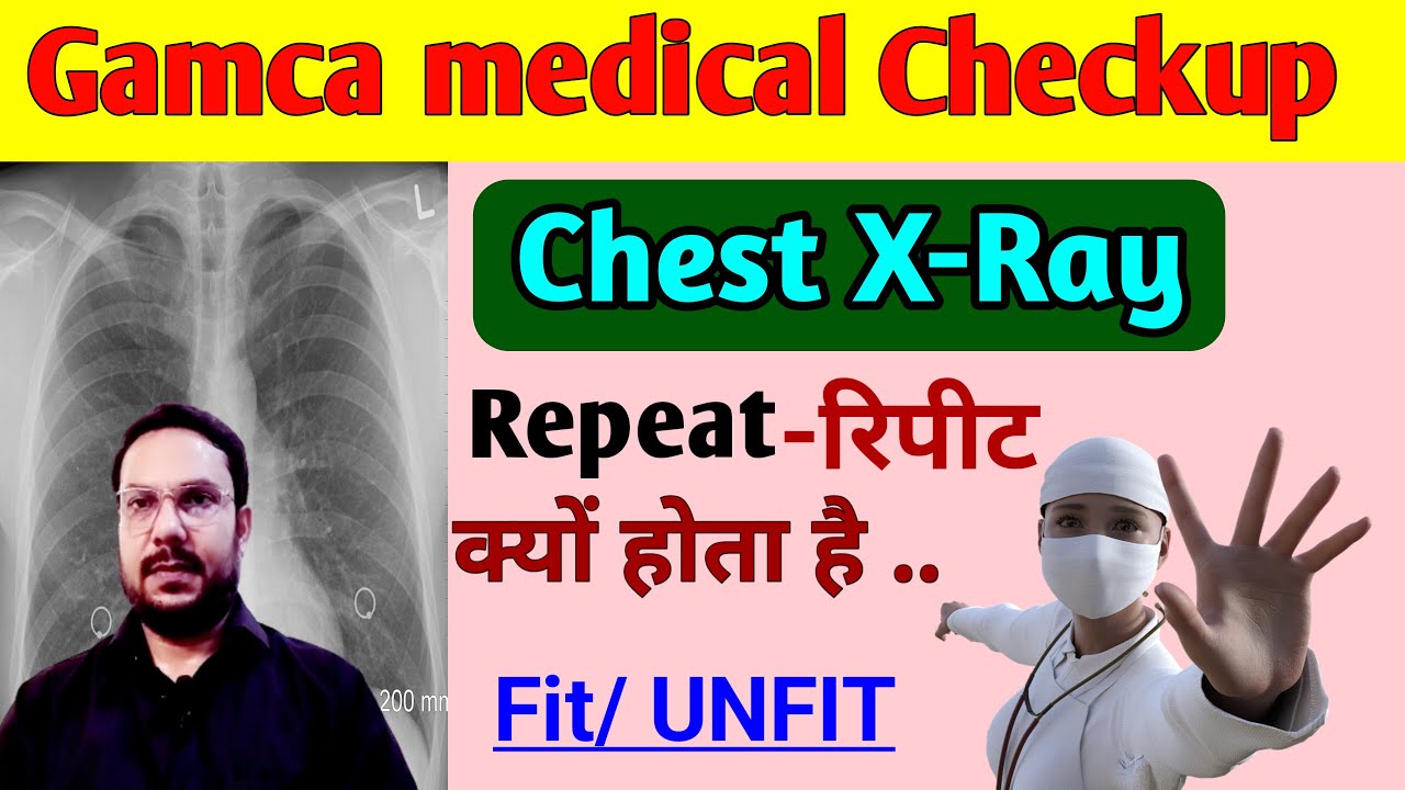 Gamca medical chest x ray Repeat क्यों होता है