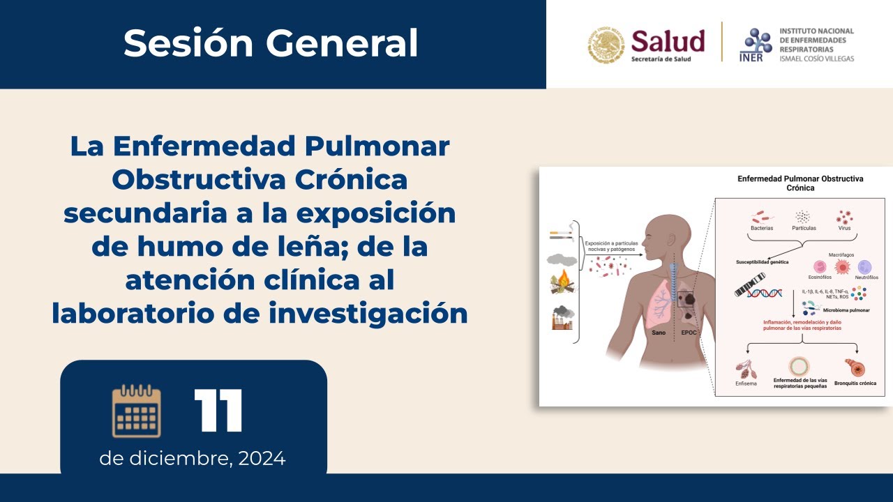 SESIÓN GENERAL: La EPOC secundaria a la exposición de humo de leña