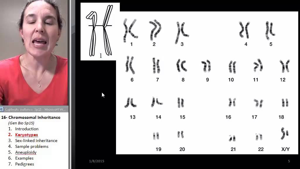 Chromosomes 2- Karyotypes