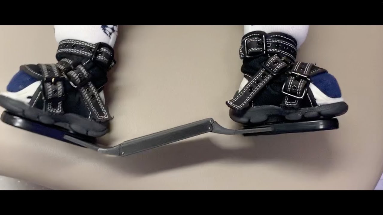 Making an impact: Protostudios team refines Iowa clubfoot treatment device