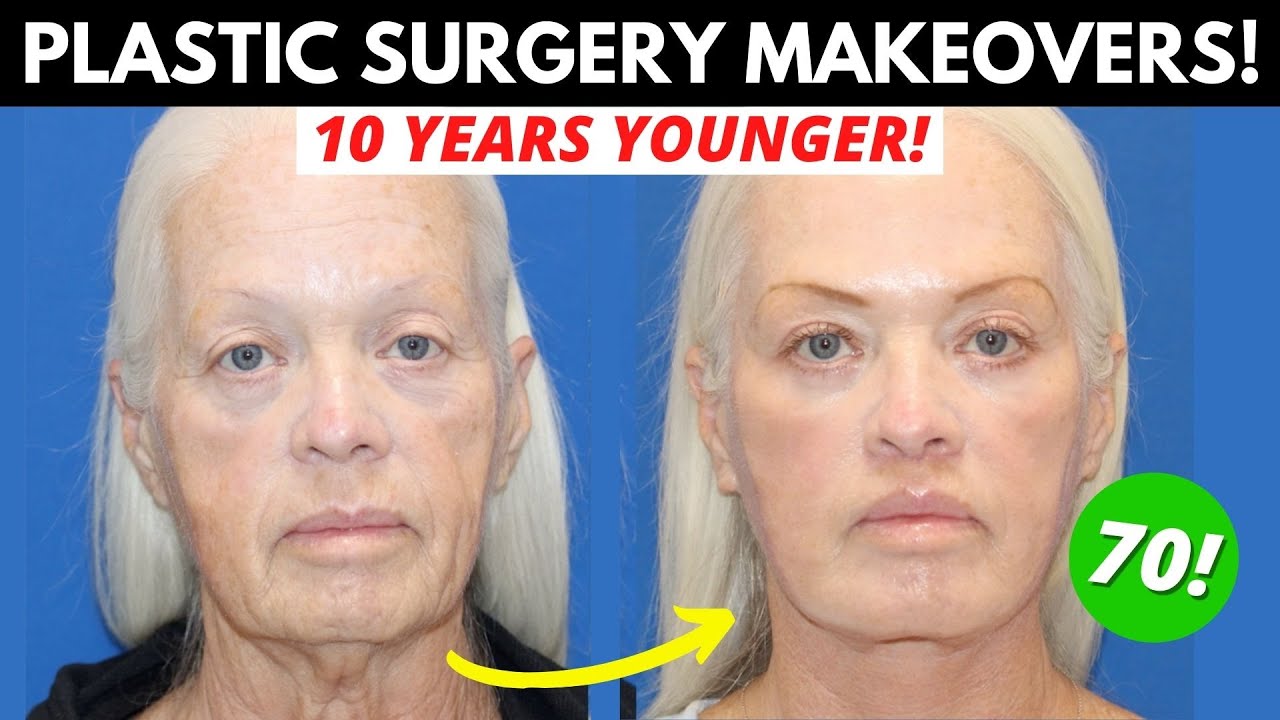 4 Women Get Life-Changing Plastic Surgery Makeovers: Everything They Had Done!