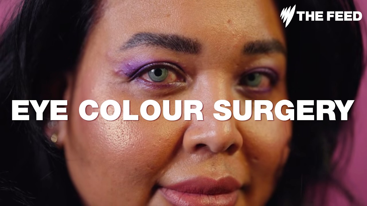 Inside Samantha's permanent eye colour change procedure
