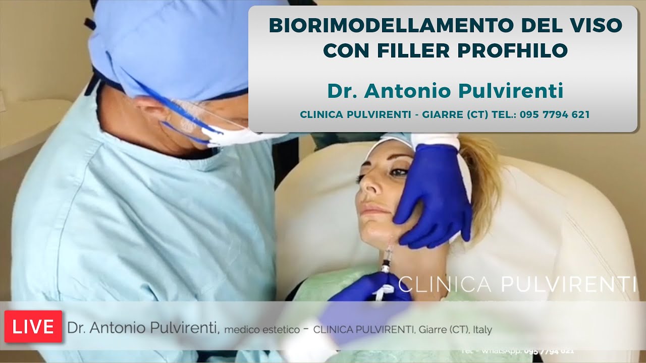 FILLER VISO CON PROFHILO - CLINICA PULVIRENTI - Dott. Antonio Pulvirenti Giarre (Catania).