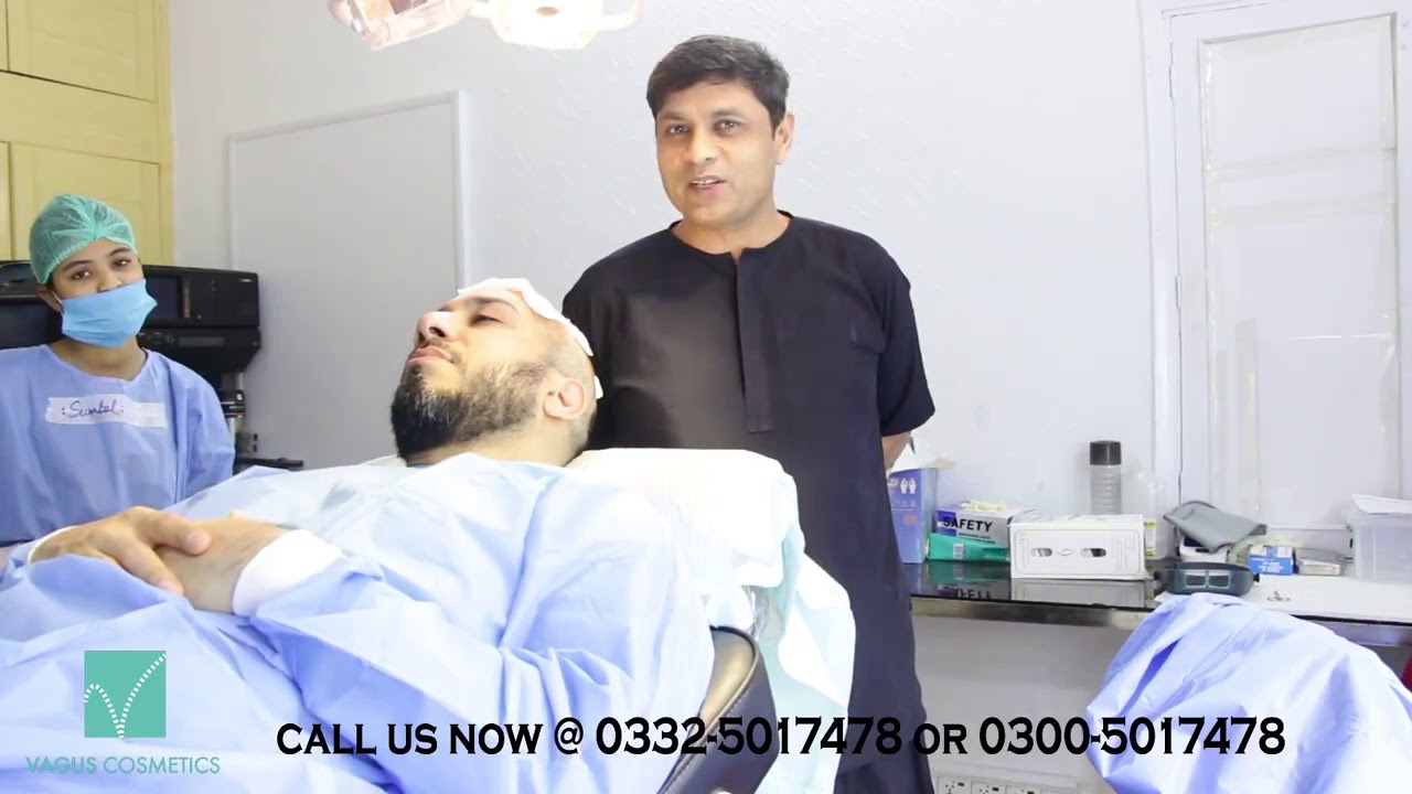 Smoking, Alcohol in hair Transplant Surgery