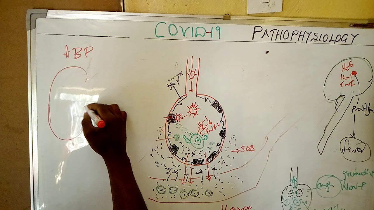 Medicine covid19 -pathophysiology 2