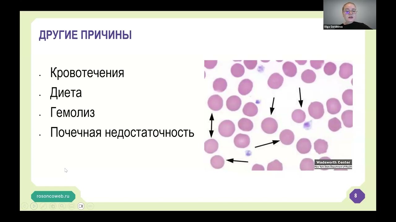 Академия RUSSCO для подготовки к экзамену ESMO: Анемия. Тромбоцитопения (31 августа 2025)