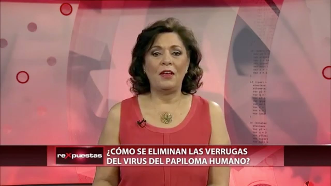 ▶️ &iquest;C&oacute;mo se eliminan las verrugas del Virus del Papiloma Humano?