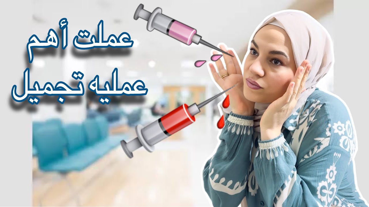 عملية التجميل يلي غيرت من شكلي كتير💉ماقدرت خبي 😕روتين امراة سورية في الغربة🥰