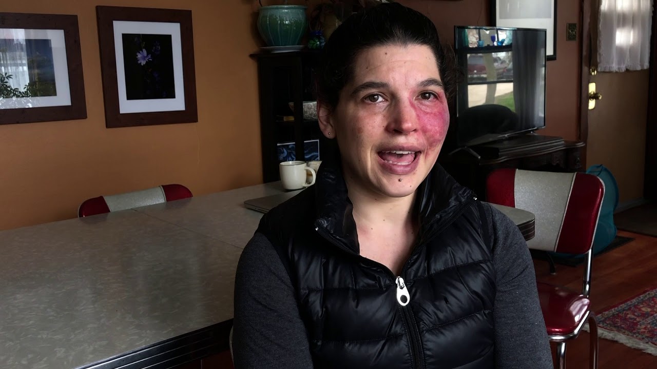 Shari's story in her own words