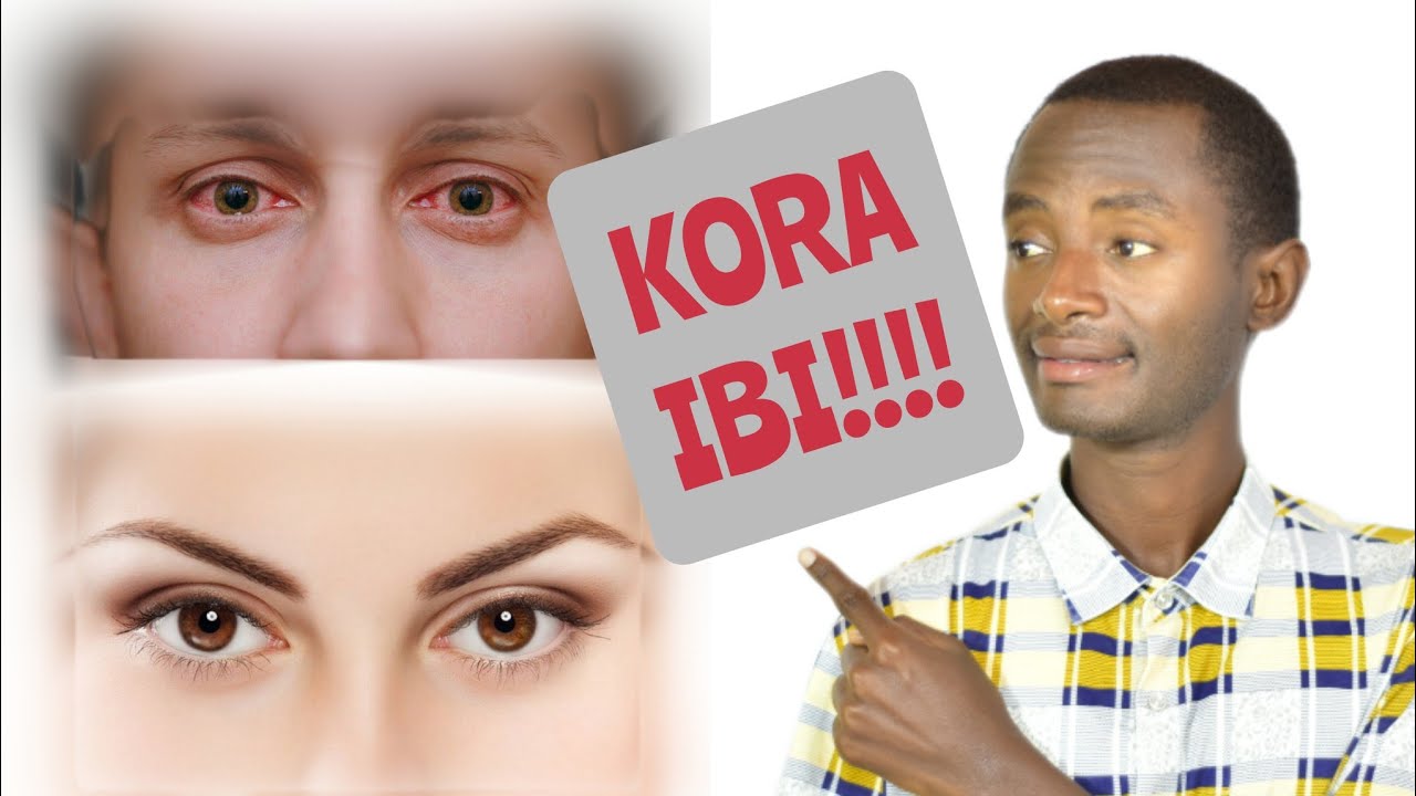 Dore imiti myiza ituma AMASO areba neza!