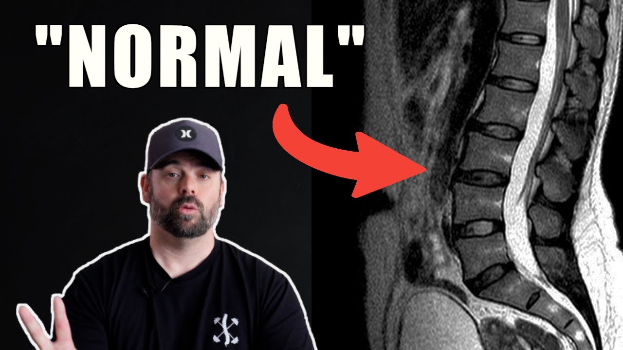 Моя МРТ в норме. Почему у меня болит спина?
