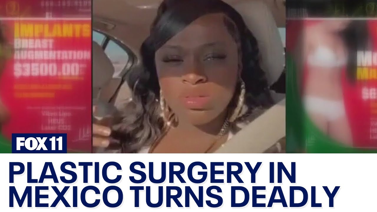LA woman dies during plastic surgery in Mexico