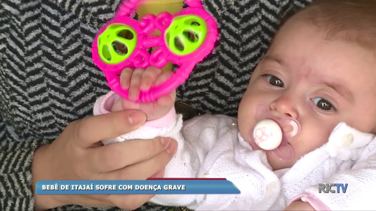 Bebê sofre com doença grave e precisa de ajuda em Itajaí