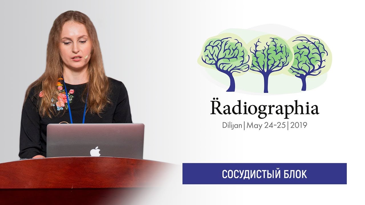 Марина Пекшева. Осложнения внутрисосудистых вмешательств при лечении ишемического инсульта.
