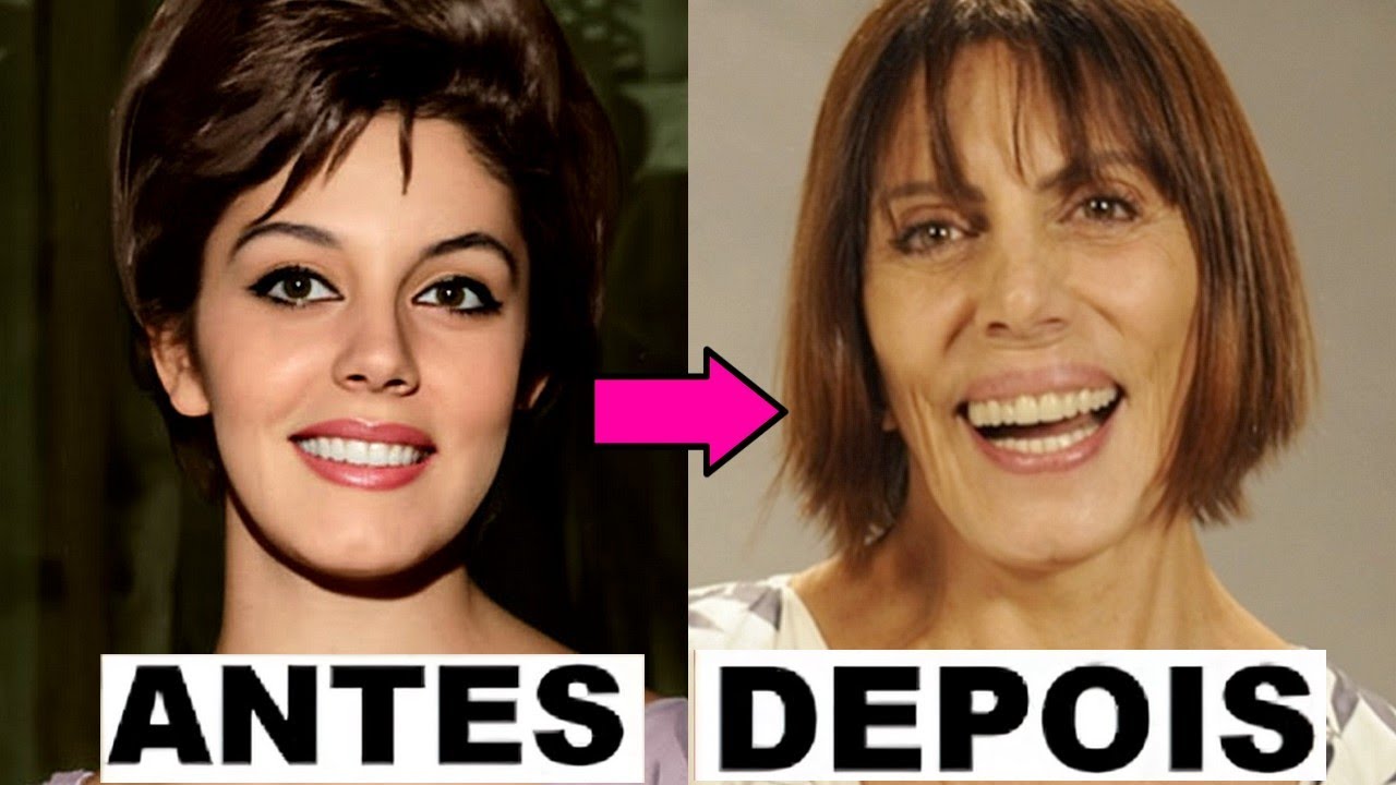 📺 Atrizes Pioneiras da TV Brasileira: Antes e Depois ✨ De Jovens à Maturidade| Volume 3 🎭