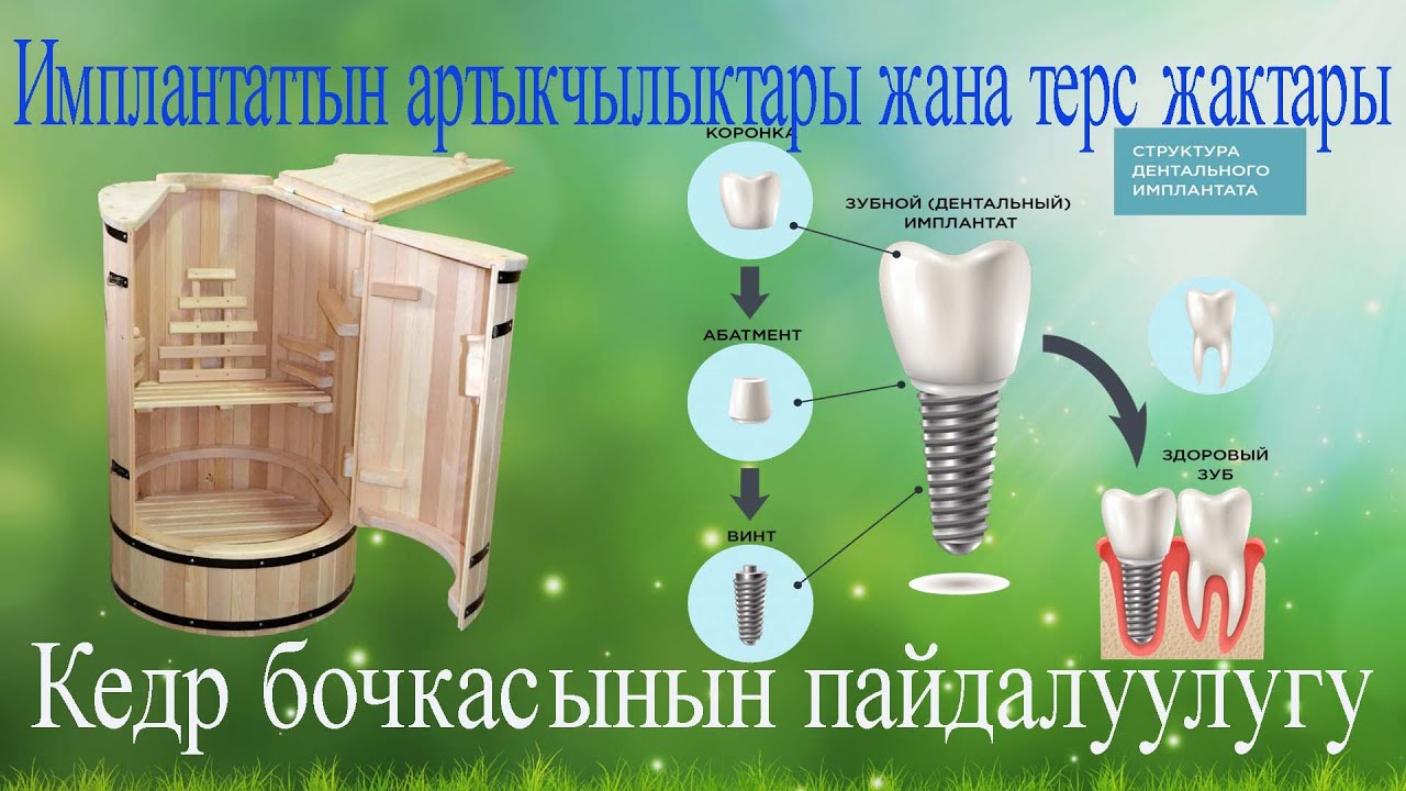 Имплантаттын артыкчылыгы жана терс жактары