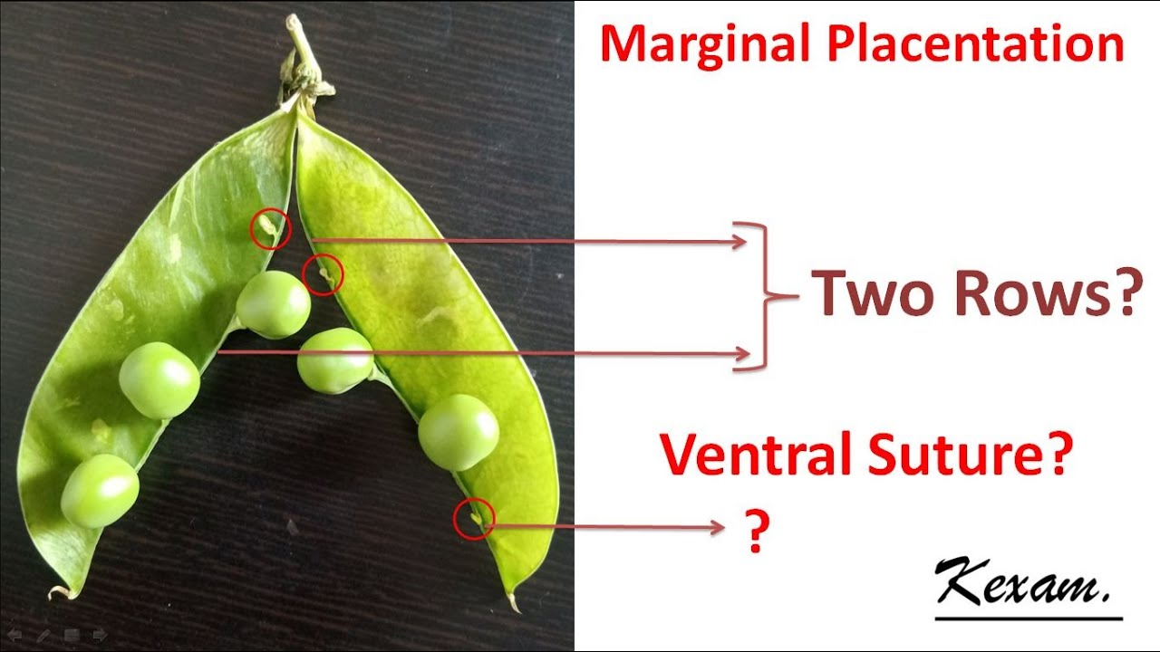 Marginal Placentation Explained I NCERT NEET Biology 