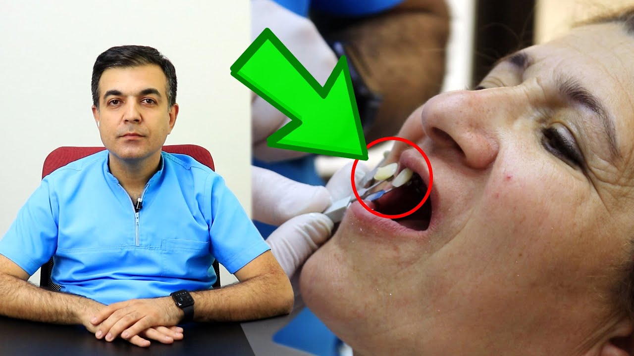 Bu dişi QƏTİYYƏN ÇƏKDİRMƏYİN! - Yoxsa...