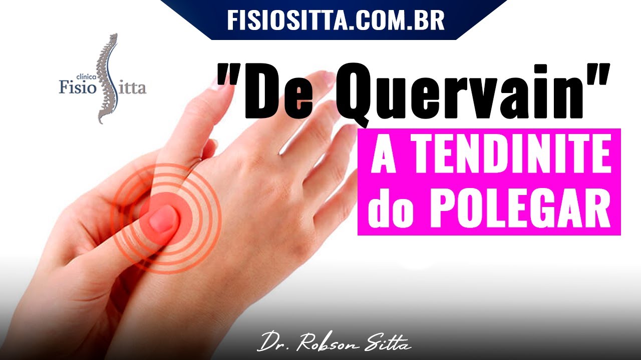 TENOSSINOVITE DE QUERVAIN BANDAGEM KINESIO TAPE TENDINITE do POLEGAR Fisioterapia Dr. Robson Sitta
