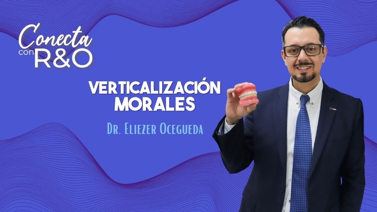 Temp. 2 Ep. 4: Verticalización Molares