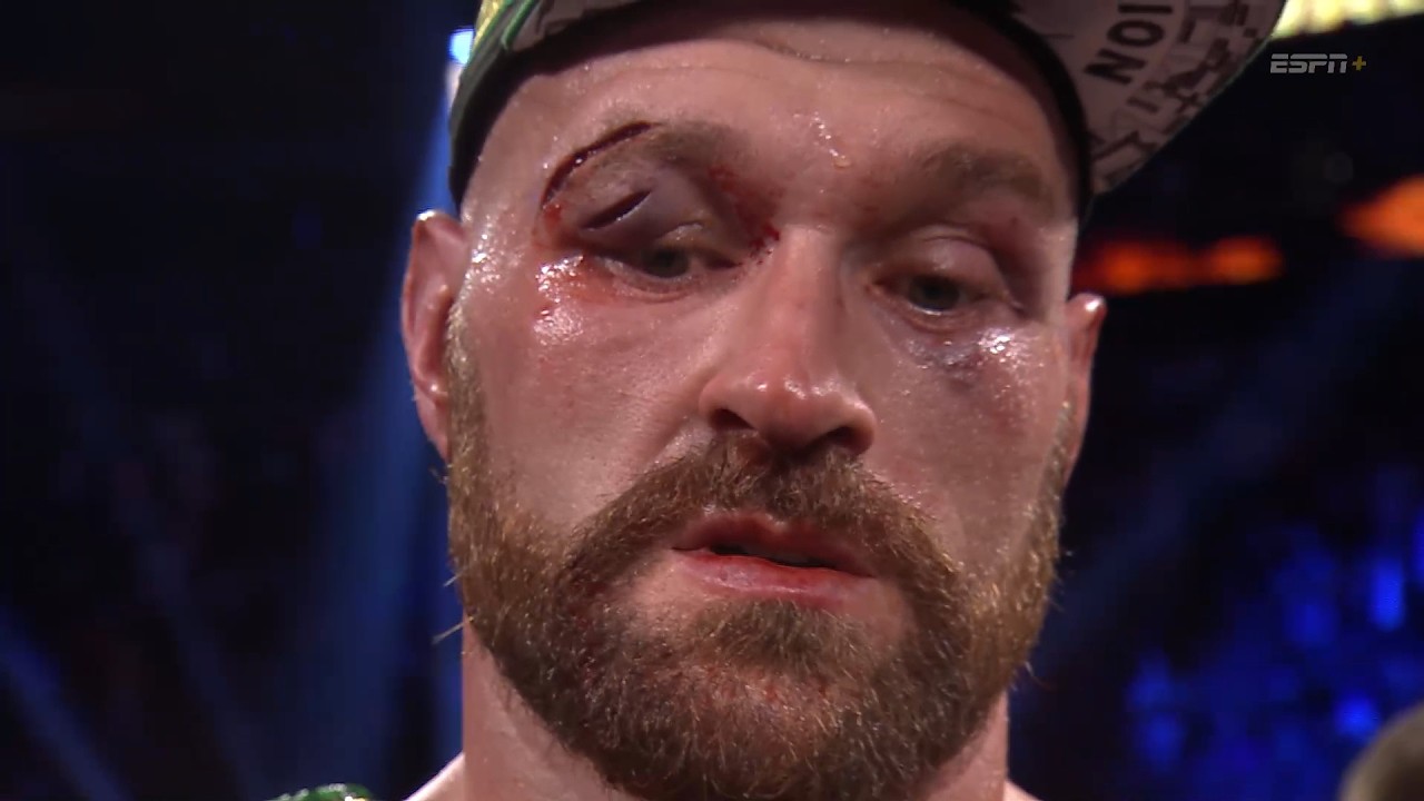 Tyson Fury (ENGLAND) vs. Otto Wallin (SWEDEN) | 4K - FULL HIGHLIGHTS #boxing #sports