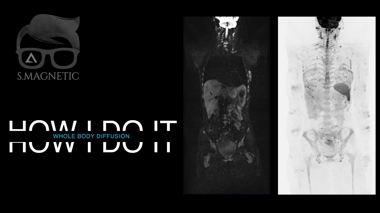 HOW I DO IT - WBDWI
