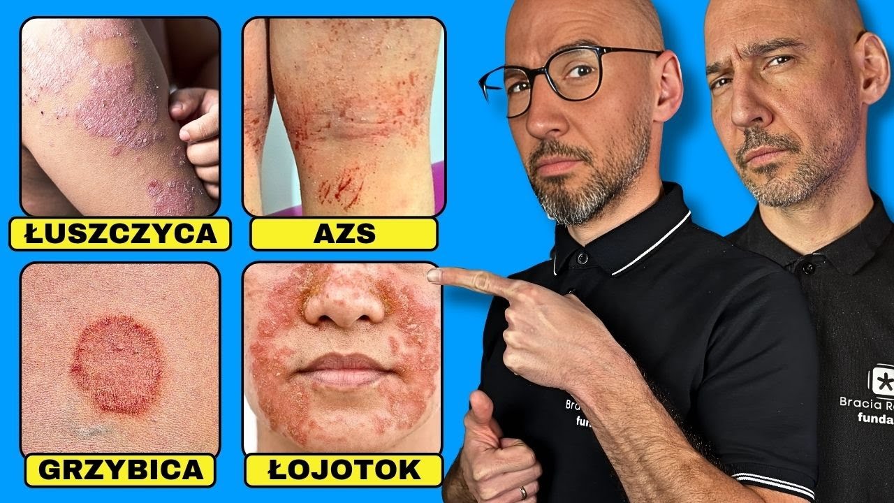 #1 Niedob&oacute;r We Wszystkich Chorobach Zapalnych Sk&oacute;ry