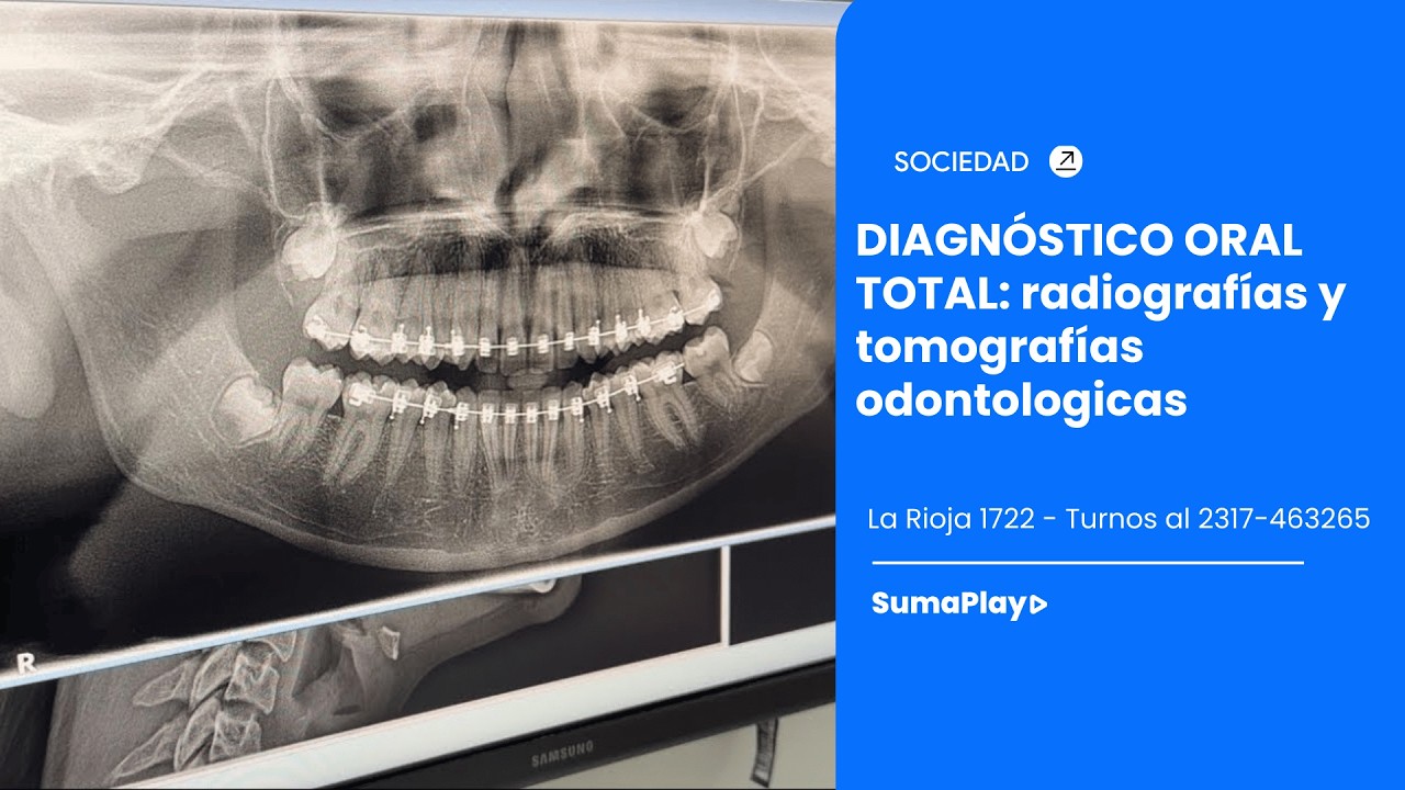 DIAGNÓSTICO ORAL TOTAL: radiografías y tomografías odontologicas 