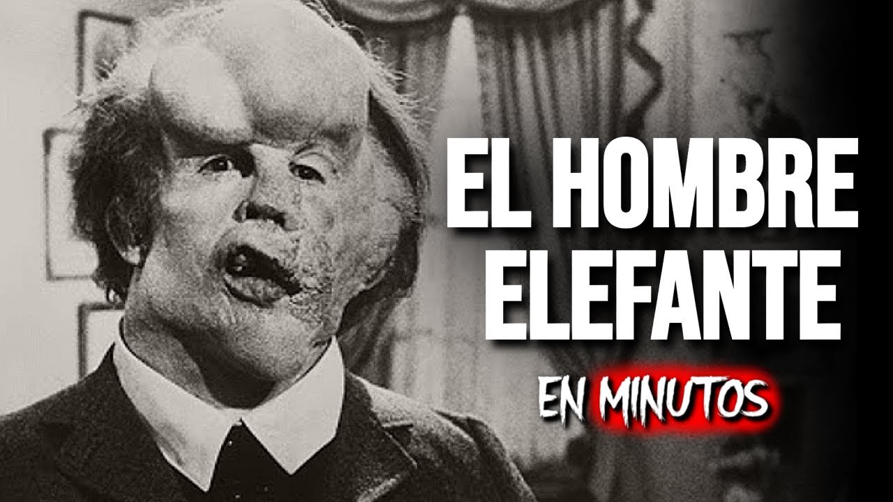 EL HOMBRE ELEFANTE | RESUMEN COMPLETO