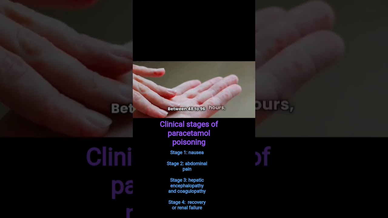 &ldquo;4 Stages of Acetaminophen Overdose Every Med Student Must Know!&rdquo; #acetaminophen #baclofen