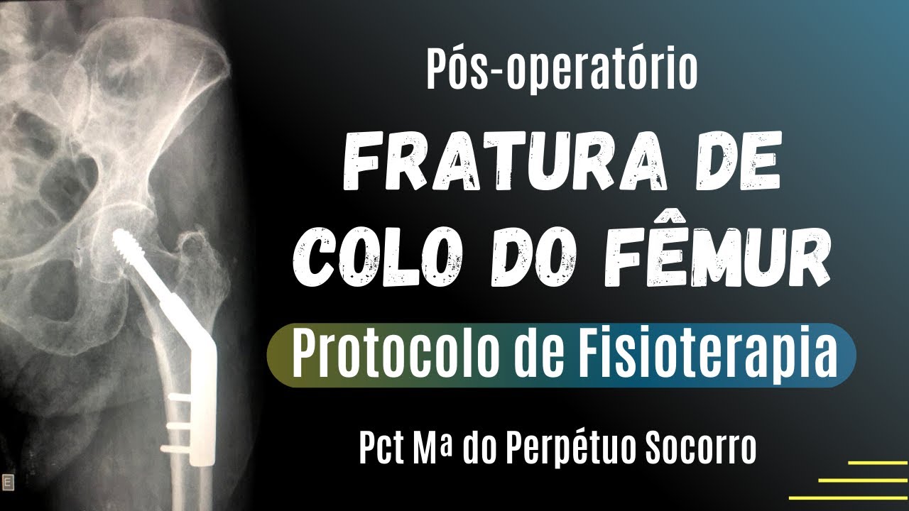 Como Tratar Fratura de Colo do Fêmur - Protocolo de Fisioterapia