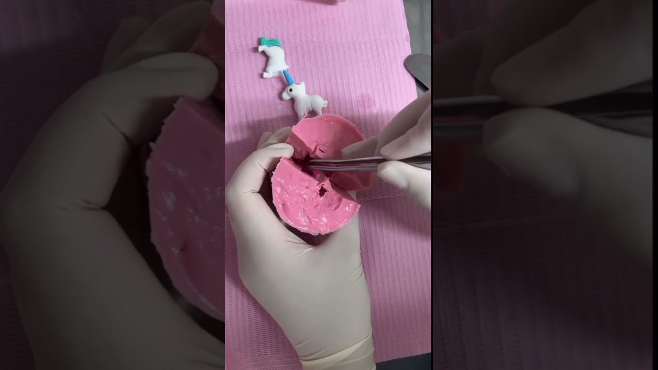 ¿Cómo hacer una figura con alginato y yeso? #odontologia #alginato #yesodental