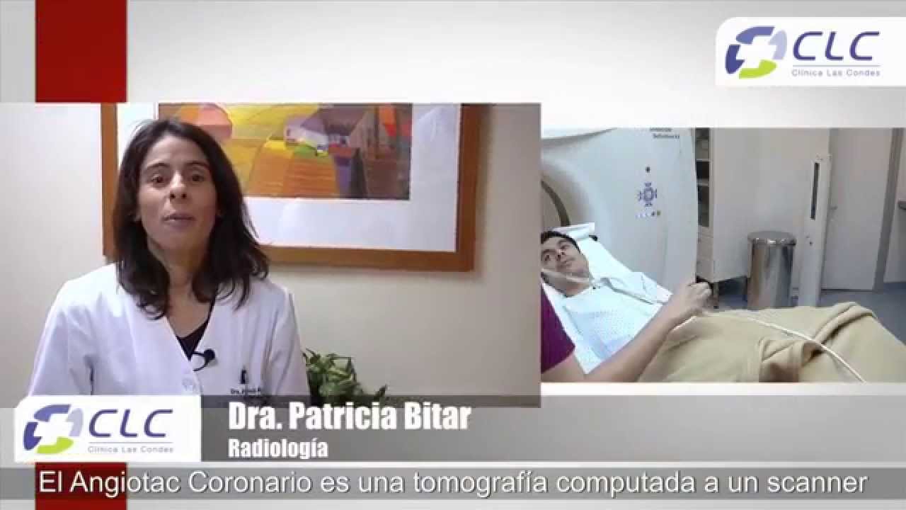 Procedimientos Cardiolog&iacute;a: Angiotac Coronario [Cl&iacute;nica Las Condes]