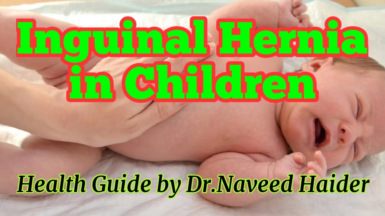 Inguinal hernia in children/Inguinal hernia treatment/ hernia ka ilaaj in urdu/hindi