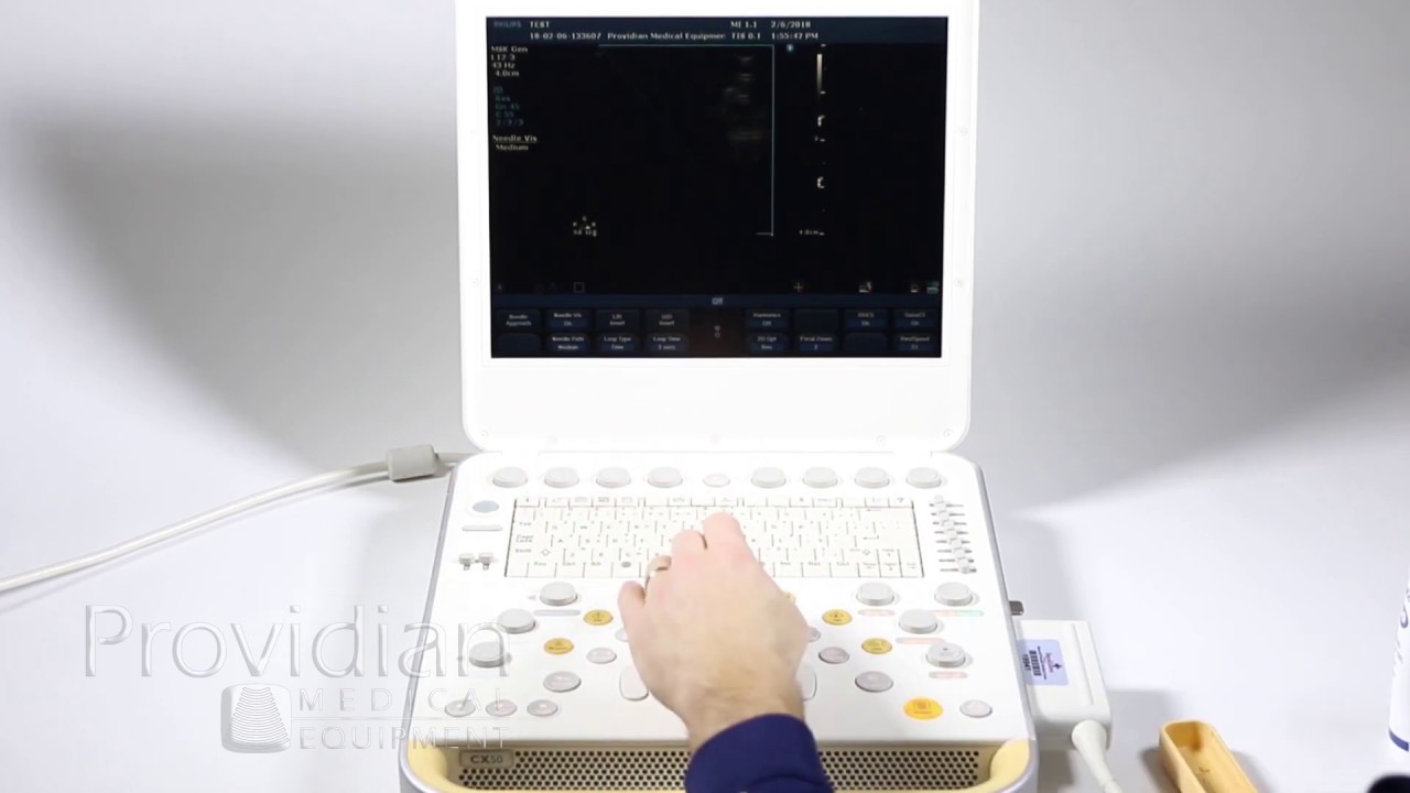 Philips CX50 Training Part 2: 2D Imaging, Optimization, and Needle Visualization