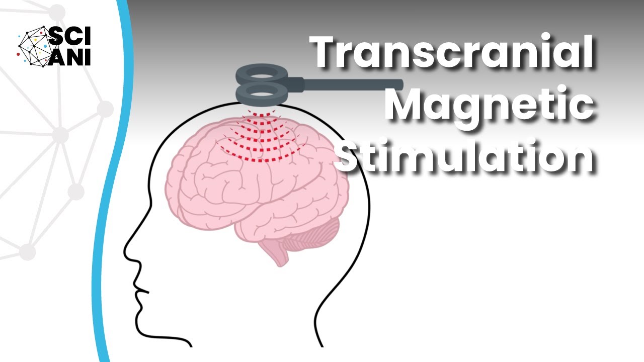What is Transcranial Magnetic Stimulation and how can it help me?