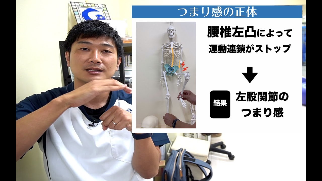 【側弯症　悩み相談＃4】階段を登るときだけ左足の付け根が詰まる感じがあるのは側弯症の影響ですか？解消法を教えてください