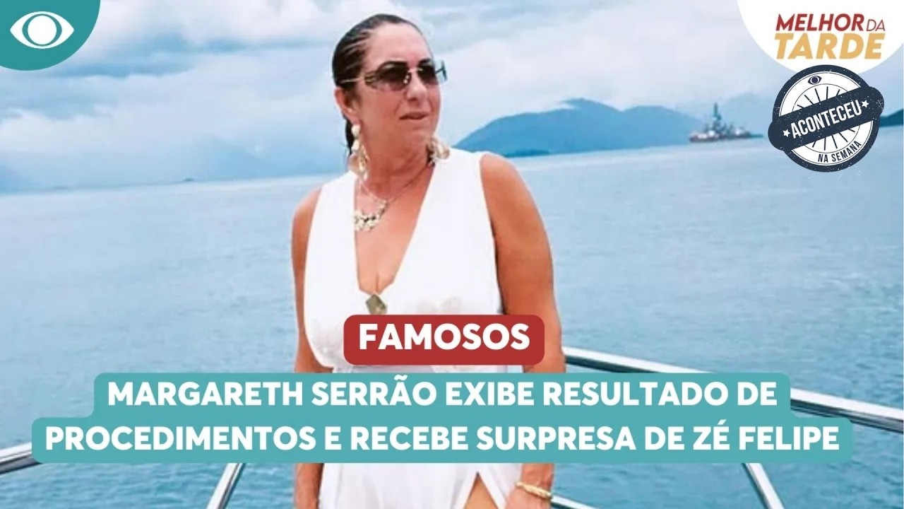 Margareth Serrão exibe resultado de procedimentos | Aconteceu Na Semana