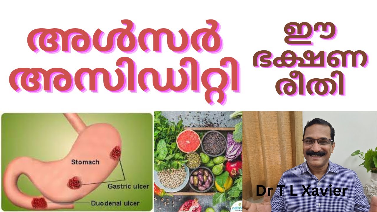 അൾസർ അസിഡിറ്റി ||  Ayurvedic Diet for Acidity & Ulcers