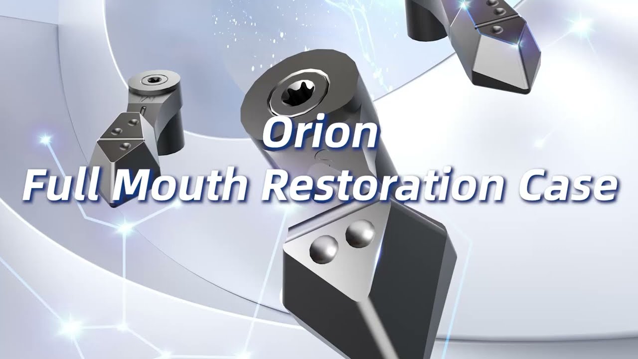 Orion Kit - Clinical Edentulous Workflow in Action