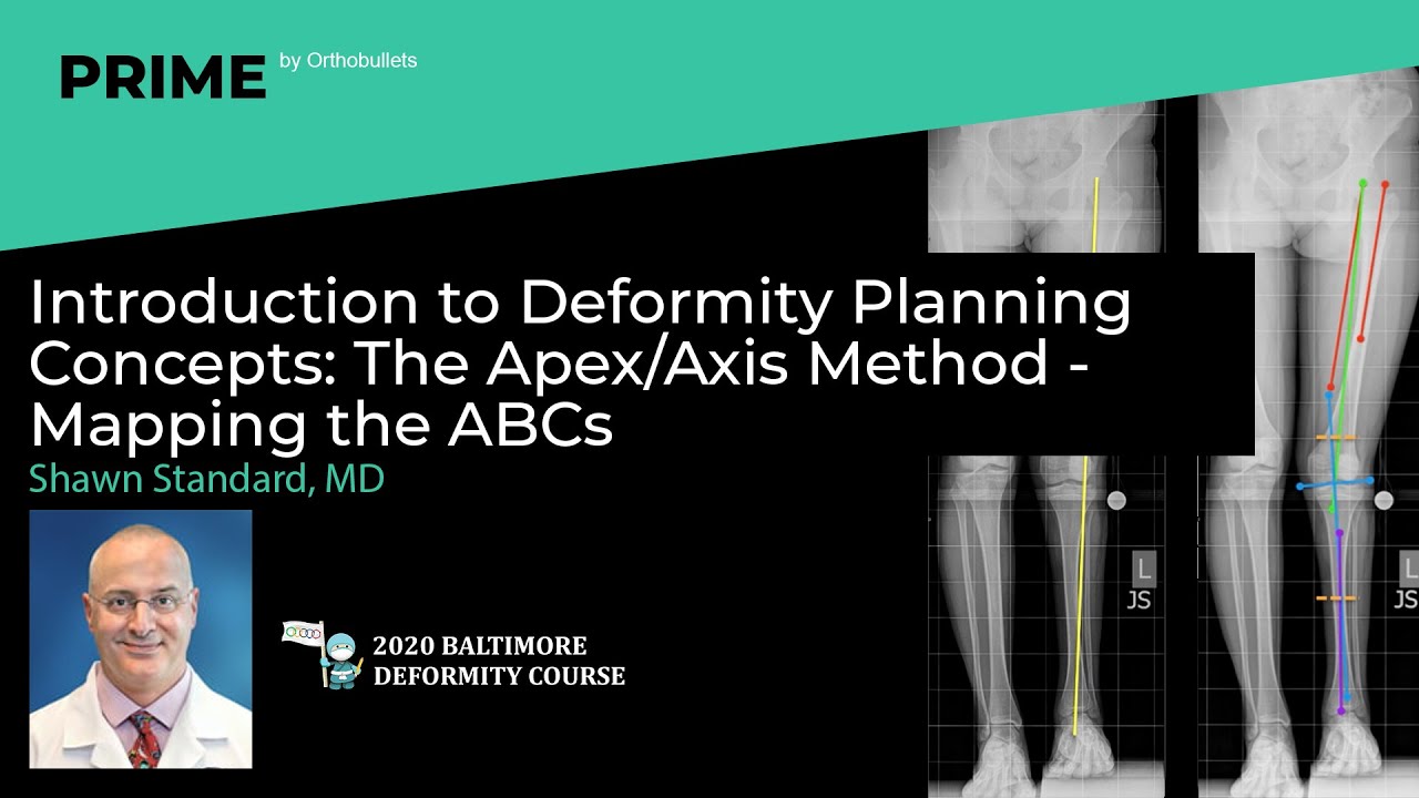 Introduction to Deformity Planning Concepts: The Apex/Axis Method - Shawn Standard, MD