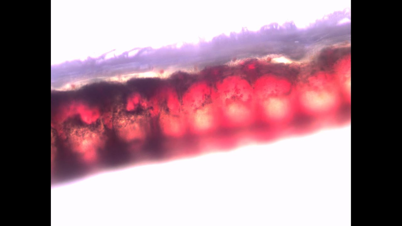 Blackworm (Lumbriculus variegatus) under microscope