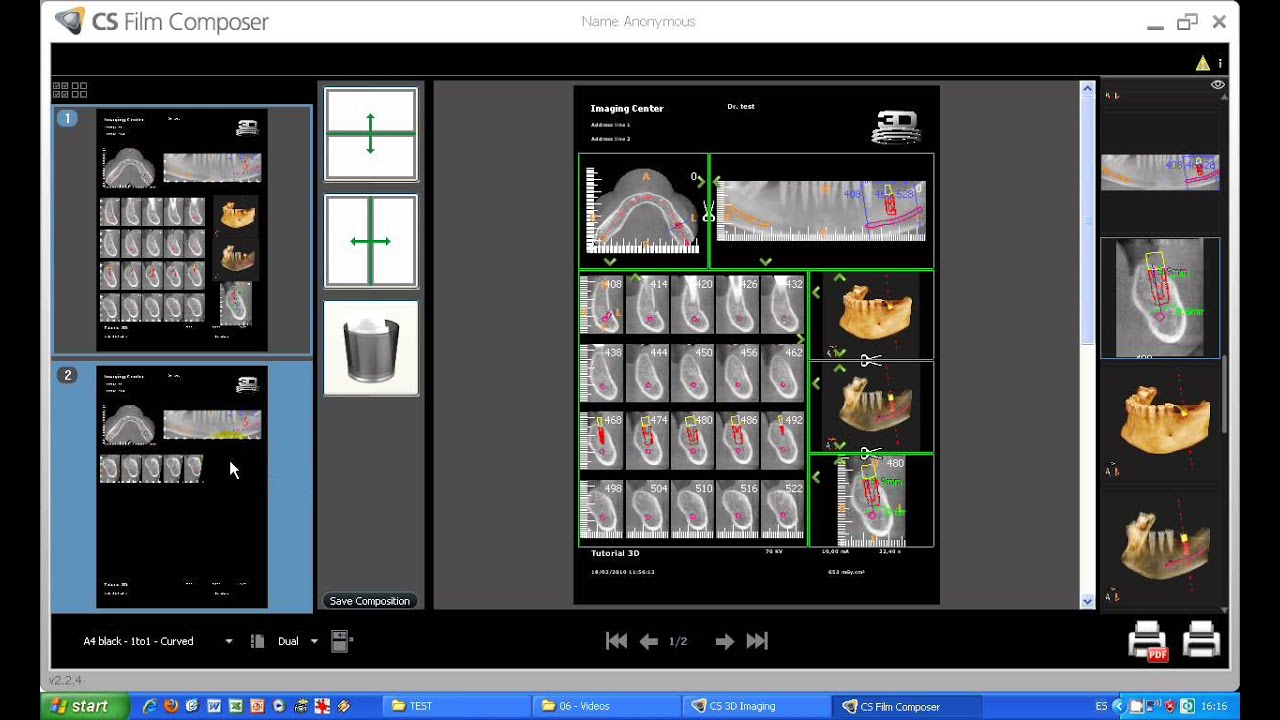 Tutorial CS 3D imaging software. 15-Carestream. Impresion hasta 25 cortes.avi