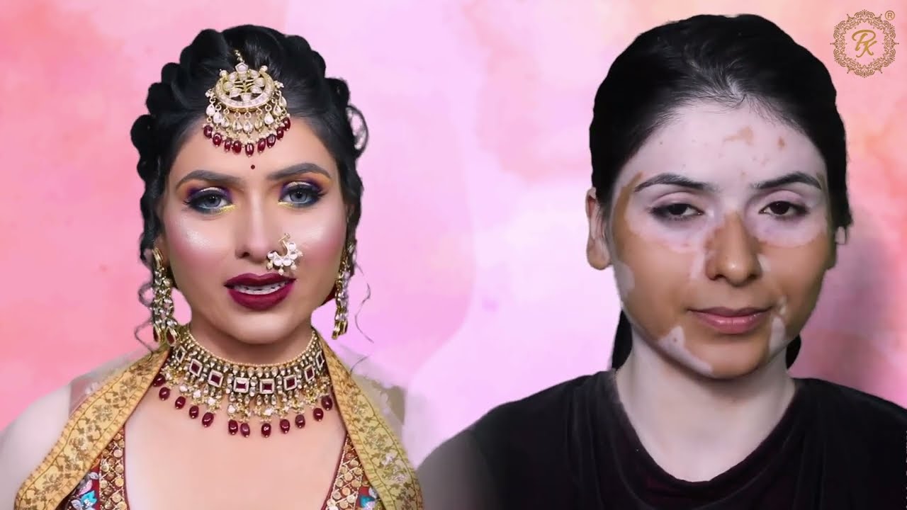 How to Cover सफेद दाग #Vitiligo #Leucoderma  Makeup transformation | Makeup Tutorial @pkmakeupstudio
