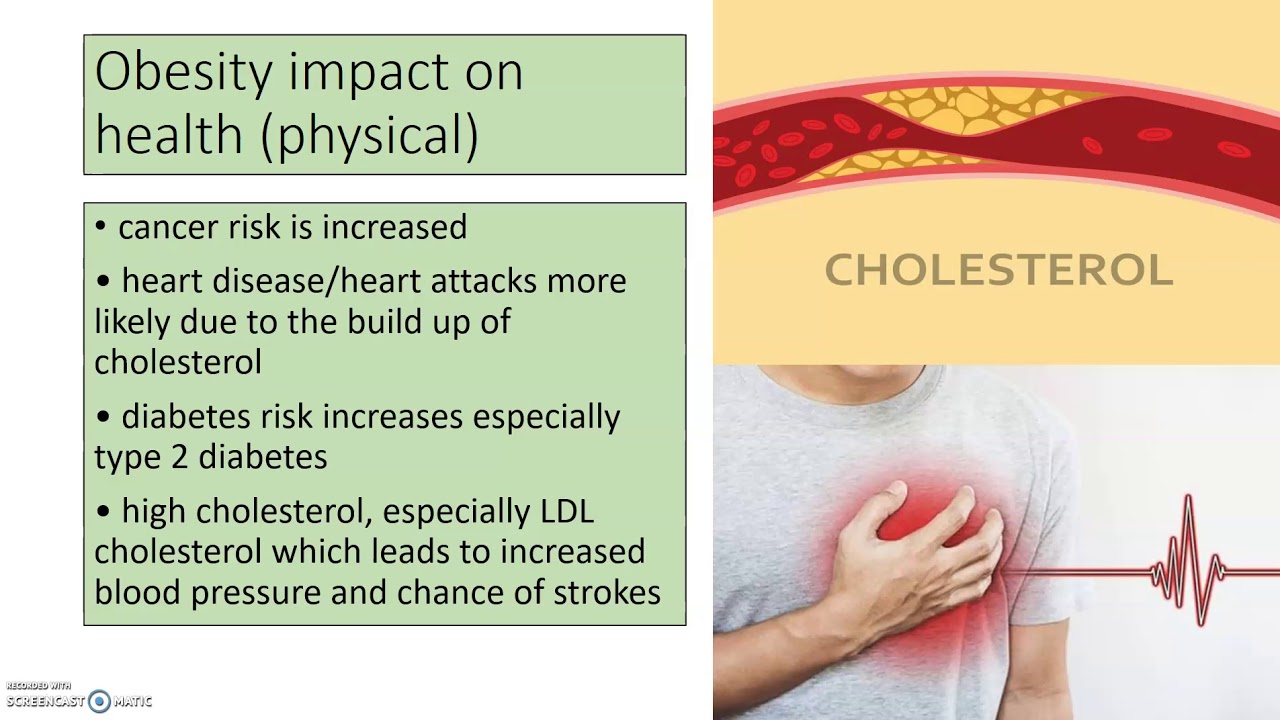Obesity and Somatotypes GCSE PE