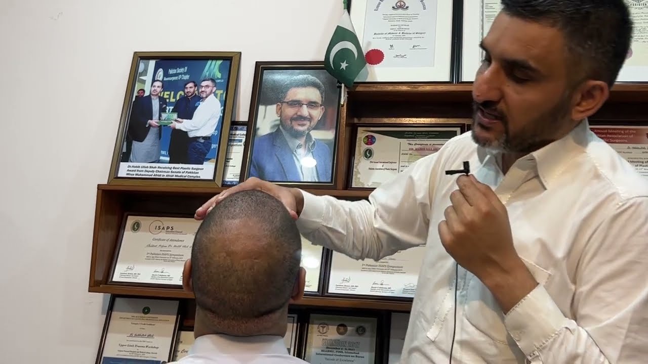 What happens after 7 day of transplant?  First Seven Days of HairTransplant || Dr. Habib Clinic