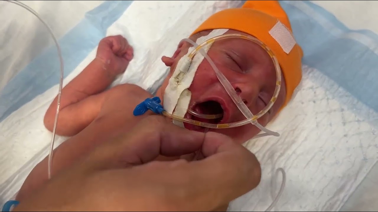 Professional OG Tube Care & Mouth Suctioning for a Newborn in NICU 💖👶