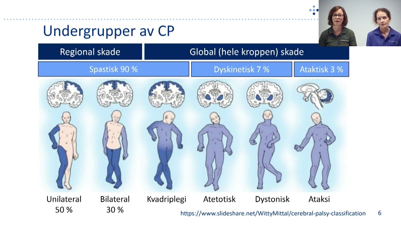 Funksjonsendring CP