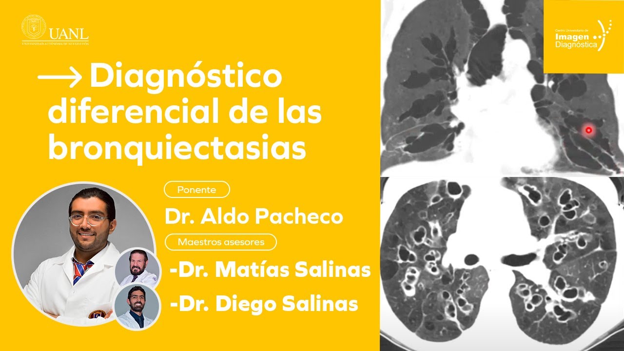 Diagnóstico diferencial de las bronquiectasias por el Dr. Aldo Pacheco.